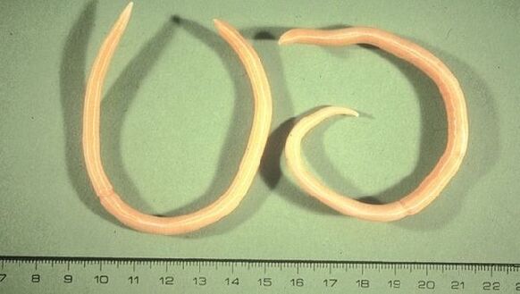 Roundworms - nekearekin eta eztularekin agertzen diren zizareak